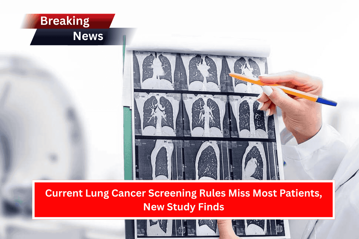 Current Lung Cancer Screening Rules Miss Most Patients, New Study Finds